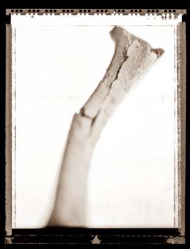 bone1